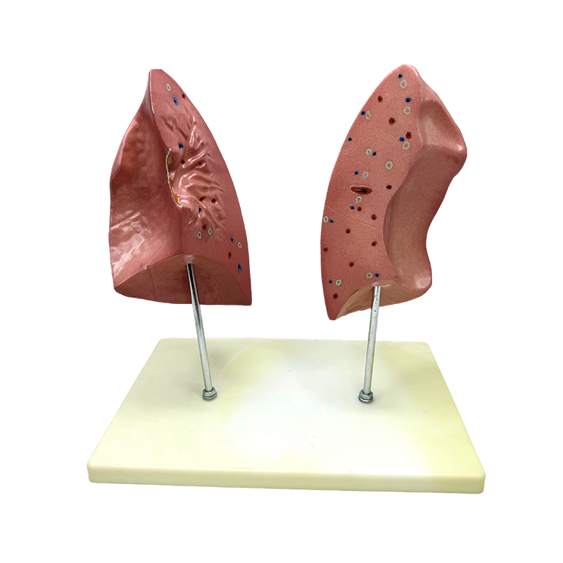 Modelo biológico de enseñanza Modelo de pulmones izquierdo y derecho Modelo anatómico de pulmón humano